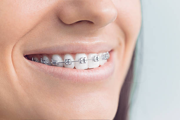 Best Dental Fillings (Composite and Amalgam)  in Sun Valley, NV